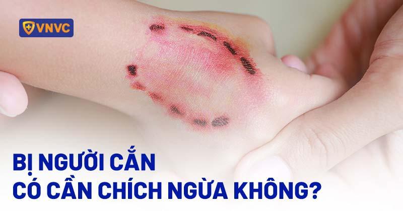 Giải Mã Giấc Mơ Thấy Cháy Nhà Xưởng Đánh Con Gì?