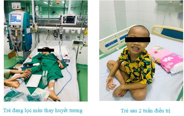 Giải Mã Giấc Mơ Thấy Cây Tiêu Và Những Con Số Liên Quan