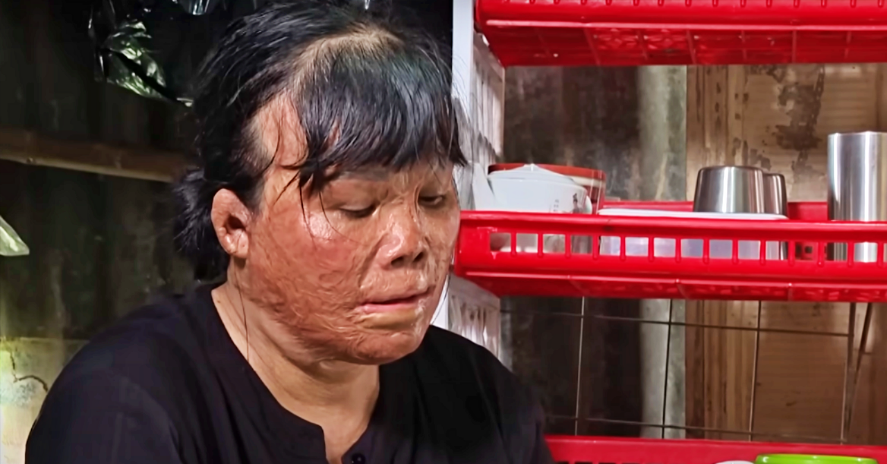 Cách Trị Bệnh Ngủ Nằm Mơ Hiệu Quả