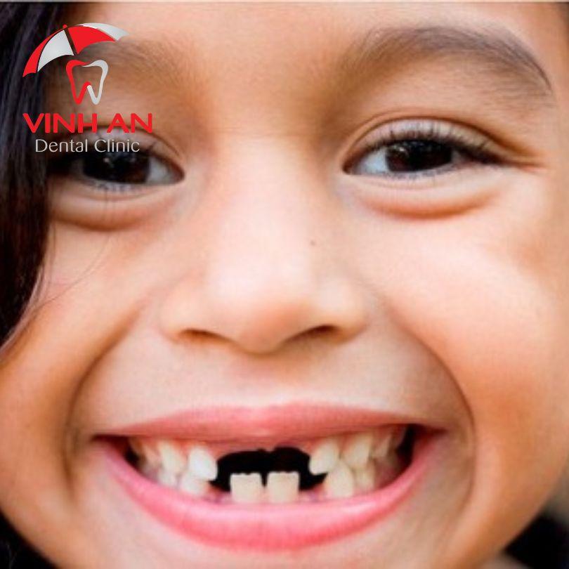Giải Mã Giấc Mơ Thấy Chùa Bị Cháy Và Số Đề Liên Quan