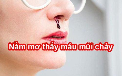 Giải mã giấc mơ chảy máu mũi đánh đề