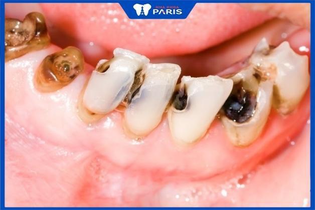 Giải Mã Giấc Mơ Nằm Mơ Bắt Được Nhiều Cá Rô Phi
