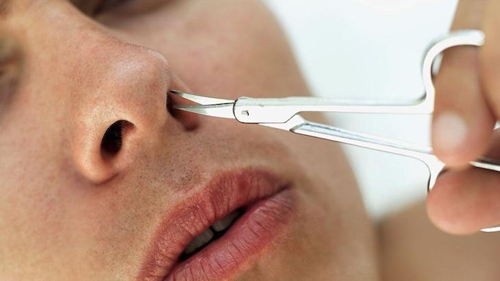 Lông mũi dài và số đề: Tìm hiểu ý nghĩa
