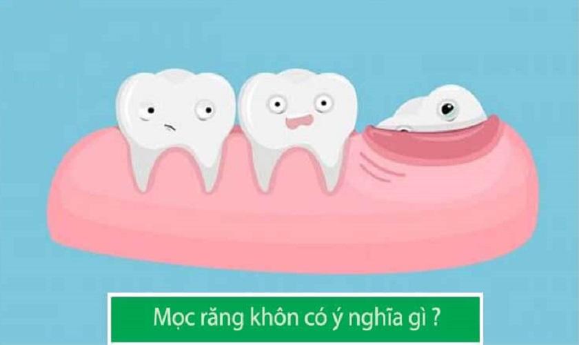 Mọc răng khôn số may mắn