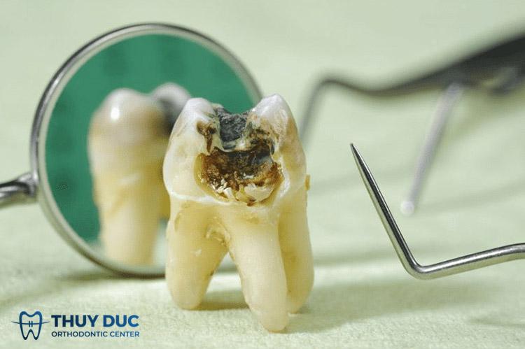 Nằm Mơ Thấy Mình Bị Đâm Chết: Giải Mã Số Đề