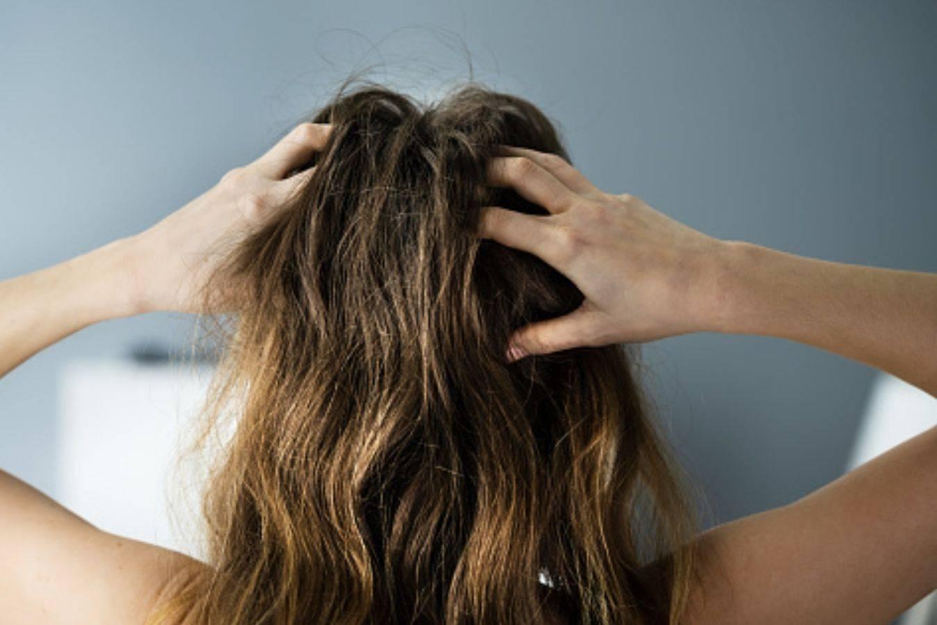 Nằm mơ thấy tóc có gàu và gãi đầu