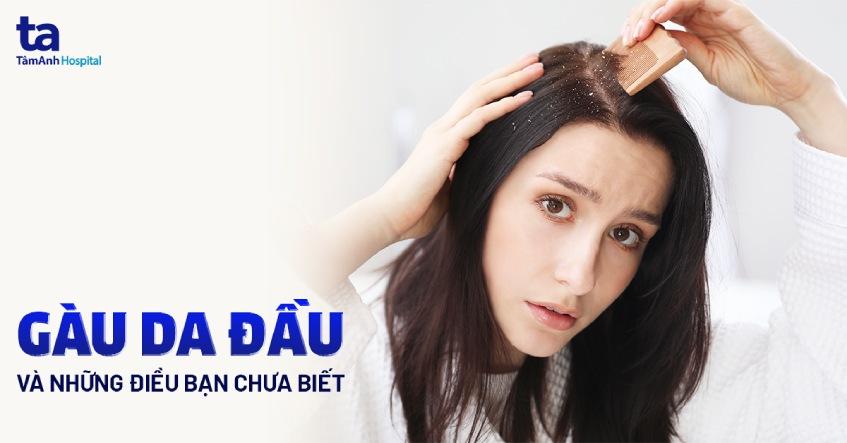 Nằm mơ thấy người khác có gàu