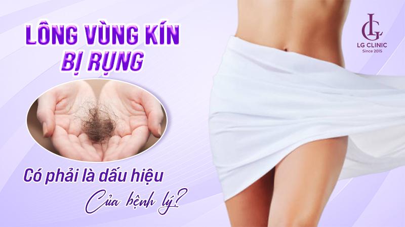 Rụng lông vùng kín số đề